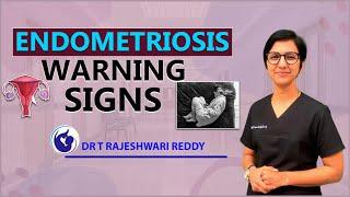 Endometriosis Warning Signs & Symptoms | Dr. Rajeshwari Reddy Explains
