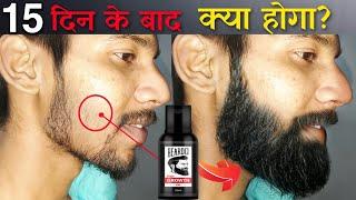 Beardo Hair Growth Oil After 15 Days Review | Best Beard Oil For Patchy Beard in India 2022