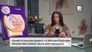Alyaa Gad - Uterine Fibroids (Myomas)