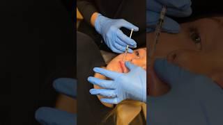 It was THERAPY #beauty #lipfiller #lipinjections #beautytips #medspa