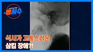 식사가 고통스러운 삼킴 장애?! 불안한 식사 시간… MBN 230712 방송