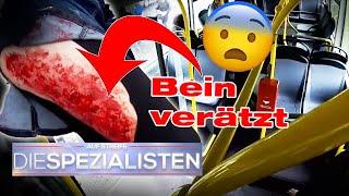 "Das brennt!" ​ Jemand hat der Schülerin das Bein VERÄTZT - Aber wer? ​| Die Spezialisten | SAT.1