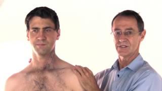 Trigger Point Therapy - Treating Sternocleidomastoid (SCM)