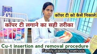 Insertion and Removal of CuT procedure/ Family planning methods/ Demonstration/ Nursing practical