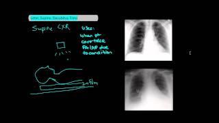 Types of Chest X-Rays part 2 - Lateral, Supine, Decubitus [UndergroundMed]