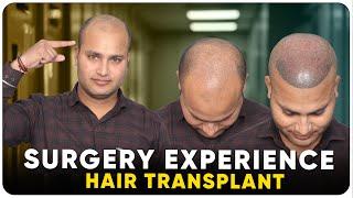 Hair Transplant in India | Best Results & Cost of Hair Transplant in India