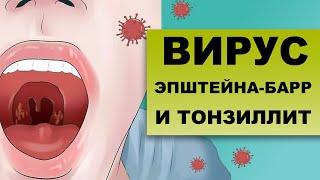 ХРОНИЧЕСКИЙ ТОНЗИЛЛИТ И ВИРУС ЭПШТЕЙНА-БАРР