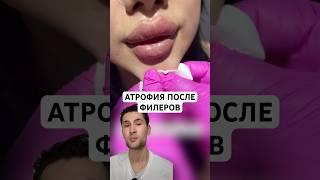 Не вводите гиперобъемы в лицо