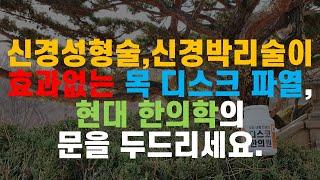 신경성형술, 신경박리술이 효과 없는 목 디스크 파열, 현대 한의학의 문을 두드리세요