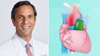 Research Alert: Ross Procedure Leads to Improved Survival Benefit for Aortic Valve Patients