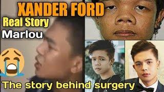 XANDER FORD - (Real story behind plastic surgery)