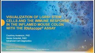 Visualization of LGR5+ Stem Cells and the immune response using RNAscope® Assay