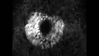 Calcium is unregulated in epithelial cells around a laser wound in the Drosophila pupal notum