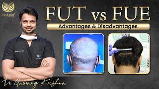 FUT vs FUE | Advantages and Disadvantages of FUT Hair Transplant over FUE Hair Transplant Technique