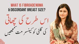 What is Fibroadenoma & Discordant Breast Size? Dr Maryam Raana Gynaecologist