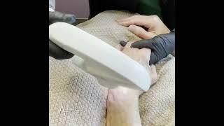 FotoFacial | Allura Clinic