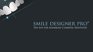 Smile Designer Pro In Action