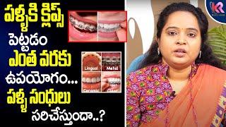 Dental Braces | Teeth Braces | Orthodontic Treatment | Dental Treatment | Karun Media Health & Homeo