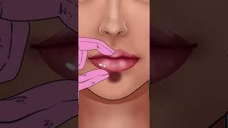 #asmr  Remove unmanaged lip piercing pus Squeeze lip #acne #animation #beauty