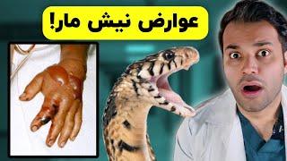 عوارض نیش مار چیه؟| ماجرای بیماری که مار شاخ دار نیشش زده بود