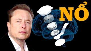 #728 Sự Thật Về Chip Não Biến Người Thường Thành "Siêu Nhân" Của Elon Musk!