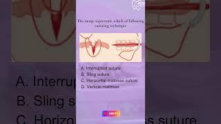 Clinical Question On Oral Surgery @medicoapps@bdsexpress.medicoapps #dental #dentist #oralsurgeon