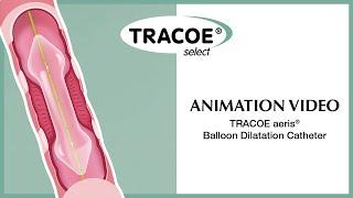 TRACOE Animation Video - The TRACOE aeris® Balloon Dilation Catheter