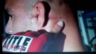 SPECIAL MMA - PART 3 of 3 - GILBERT JIMENEZ - COMEBACK FROM GUN SHOT IN FACE