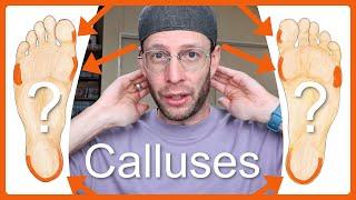 Why Are Calluses So Important to a Reflexologist?