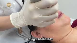 Toronto ID Cosmetic Clinic ｜多伦多ID医美诊所 徐医生神奇的红血丝消失术