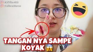 PRANK PACAR TANGAN LUKA KENA PISAU SAMPAI KOYAK!!!