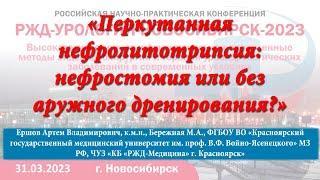 30 Перкутанная нефролитотрипсия нефростомия или без наружного дренирования