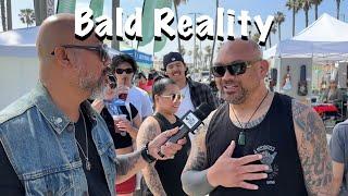 The Truth About Being Bald | Part 6