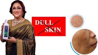 Tips to manage skin that looks dull in winter| ANJALI GANGULY | SKIN CARE TIPS