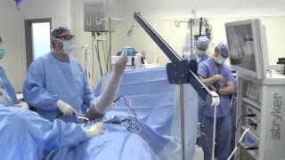 Shoulder Arthroscopy Surgery