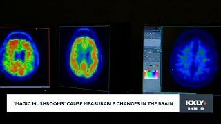 "Magic mushrooms" cause measurable changes in the brain