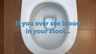 If You Ever See Blood In Your Stool-- Is It Colon Cancer or Is It Something Else?