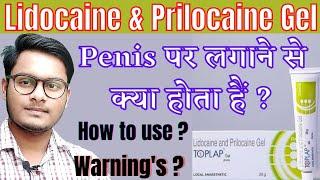 Lidocaine prilocaine cream | Lidocaine and prilocaine cream usp | Toplap gel | Toplap gel in hindi