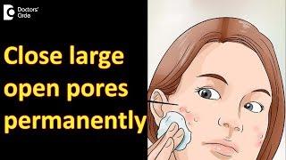 Close large open pores permanently - Dr. Rajdeep Mysore