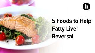 5 Foods to Help Fatty Liver Reversal | Healthline