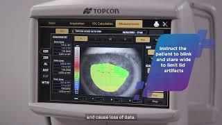 How to Determine Reliability of my Biometry Data on my Topcon Aladdin