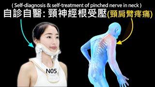 自診自醫 : 頸神經根受壓(頸肩臂疼痛) Self-diagnosis & self-treatment of pinched nerve in neck (3d 動畫) (N05)