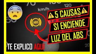 ️ Se PRENDE LA LUZ Del ABS En El TABLERO ? ESTAS SON LAS 5 CAUSAS