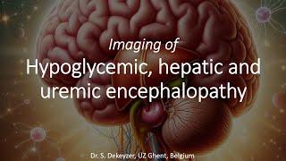 Imaging of Toxic-Metabolic Brain Disorders: hypoglycemic, hepatic & uremic encephalopathy.