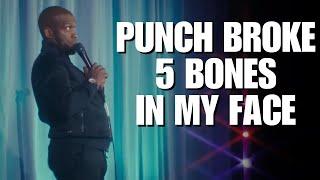 The Punch That Broke 5 Bones in My Face | The Domino Effect | Ali Siddiq Stand Up Comedy