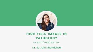 High yield images in Pathology for FMGE | Haematology | Dr. Ila Jain Khandelwal