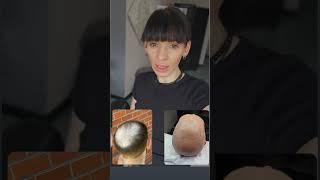 #трихопигментация #трихопигментациякраснодар #трихопигментациямосква #трихопигментацияспб #scalp