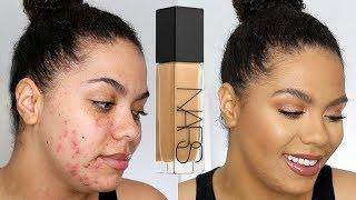 NARS Natural Radiant Longwear Foundation Review (oily/acne)