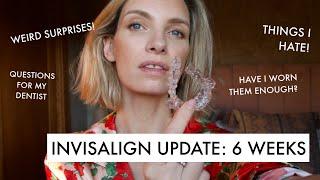 THINGS I DIDN'T EXPECT: 6 WEEK INVISALIGN UPDATE | RUTH CRILLY