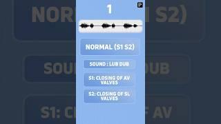 Heart sounds in different conditions #volumeup